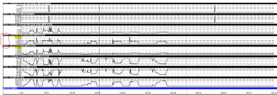 Enreg_sural_Arret.PNG (83.16 Kio) Vu 5198 fois photo enregistrement sural param sural mot tournant à l'arrêt