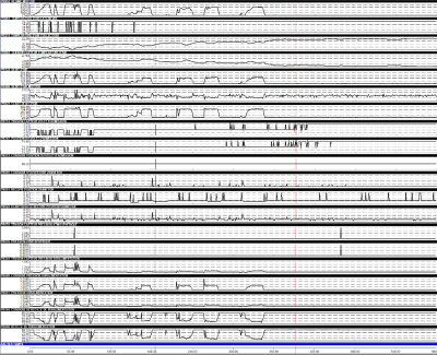 enreg_1-2-3.PNG (237.14 Kio) Vu 6508 fois param sural complets mot tournant